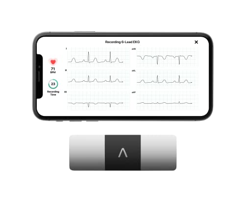 KardiaMobile 6-Lead Personal EKG Monitor – Six Views of The Heart – Detects AFib and Irregular Arrhythmias – Instant Results in 30 seconds – Works with Most Smartphones - FSA/HSA Eligible