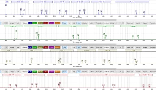 ExpressDNA Paternity Test (private test, all lab fees included, test result in 1 to 2 days)