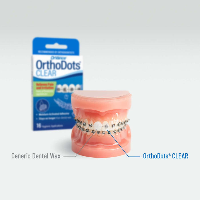 OrthoDots CLEAR – Moisture Activated Braces Wax Alternative for Pain Caused by Braces, Clear Aligner Trays, and Other Orthodontic Appliances. OrthoDots Stick Better and Stay on Longer than Dental Wax.