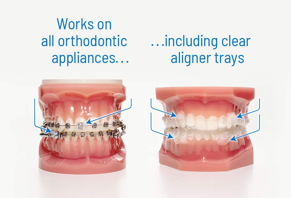 OrthoDots CLEAR – Moisture Activated Braces Wax Alternative for Pain Caused by Braces, Clear Aligner Trays, and Other Orthodontic Appliances. OrthoDots Stick Better and Stay on Longer than Dental Wax.