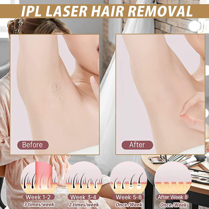 Laser Hair Removal for Women Permanent，Hair Removal Device，Painless at-Home IPL Laser Hair Removal for Women，Whole Bodey Use-01