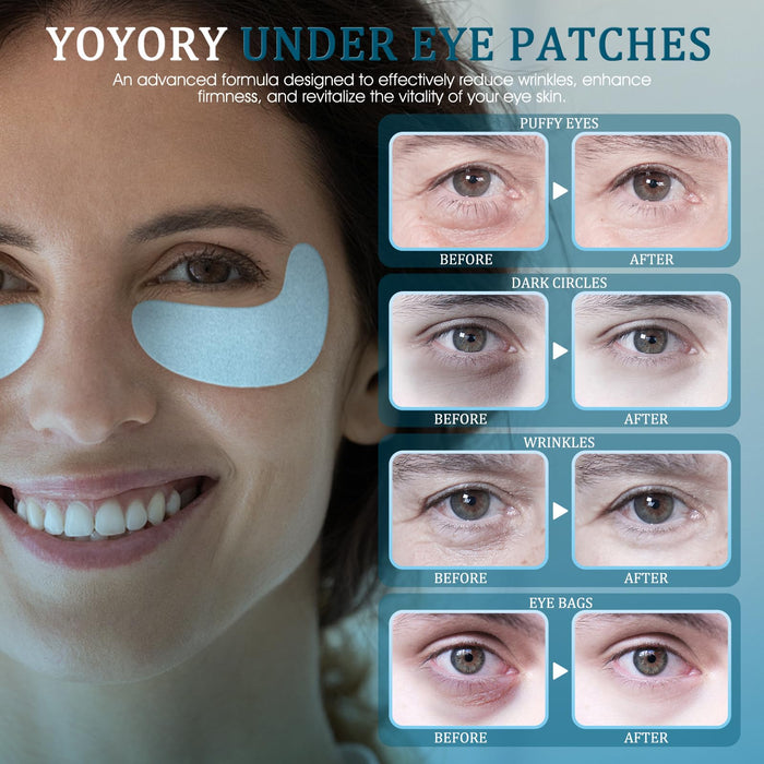 YOYORY Under Eye Patches Masks - for Dark Circles, Wrinkles, Puffy Eyes, Fine Lines, Eye Bags Treatment with Hyaluronic Acid and Collagen, Hydrating and Moisturizing (30 Pcs)